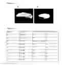 Fig. 02 - Integrated implant system (IIS) biocompatible, biodegradable and bioactive, comprising a biocompatible sterile porous polymeric matrix and a gel, integrating in situ the tridimensional matrix structure