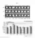 Fig. 09 - METHOD FOR DIFFERENCIATING MESENCHYMAL STEM CELL AND CULTURING CHONDROCYTES USING ALGINATE COATED FIBRIN/HA COMPOSITE SCAFFOLD