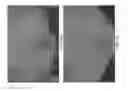 Fig. 07 - Systems and methods for skin rejuvenation