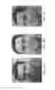 Fig. 09 - Systems and methods for skin rejuvenation