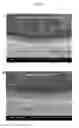 Fig. 07 - Multilayer Coatings