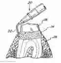 Fig. 01 - Dental retraction material having enhanced fluid absorption