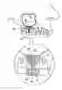 Fig. 01 - Implants, tools, and methods for sinus lift and bone augmentation