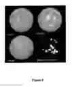 Fig. 08 - Method for detecting microorganisms on a membrane