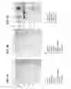 Fig. 08 - Gene upregulated in cancers of the prostate