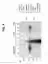 Fig. 09 - Gene upregulated in cancers of the prostate