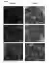 Fig. 08 - Differentiation of Human Embryonic Stem Cells
