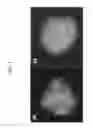Fig. 02 - PLANT STEM CELL LINE DERIVED FROM QUIESCENT CENTER AND METHOD FOR ISOLATING THE SAME
