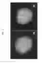 Fig. 07 - PLANT STEM CELL LINE DERIVED FROM QUIESCENT CENTER AND METHOD FOR ISOLATING THE SAME