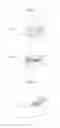 Fig. 22 - Analyzing device, analyzing apparatus using the device, and analyzing method