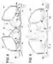 Fig. 05 - Breast saver: an ergonomic dynamic bra with combo cups