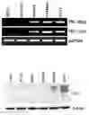 Fig. 01 - Peptide Aptamers Against Tenascin C