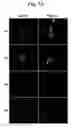 Fig. 04 - Peptide Aptamers Against Tenascin C