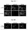 Fig. 06 - Peptide Aptamers Against Tenascin C