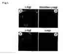 Fig. 02 - TREATMENT OF INFLAMMATION USING ALPHA 7 RECEPTOR-BINDING CHOLINERGIC AGONISTS