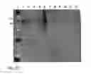 Fig. 58 - PROTEIN NODES FOR CONTROLLED NANOSCALE ASSEMBLY