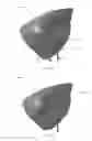 Fig. 02 - Cardiac compression system