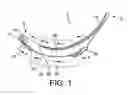 Fig. 02 - LARYNGOSCOPE INSERTION SECTION