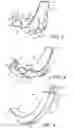 Fig. 03 - LARYNGOSCOPE INSERTION SECTION