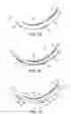 Fig. 06 - LARYNGOSCOPE INSERTION SECTION