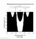 Fig. 09 - Methods, systems and devices for local magnetic resonance imaging