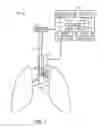 Fig. 02 - Tracheal tube locating system and method