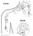 Fig. 06 - MICRO CENTRAL LINE VASCULAR ACCESS CATHETER AND METHOD OF USE