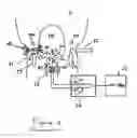 Fig. 02 - NON-INVASIVE PHOTOELECTROGLOTTOGRAPHY METHOD AND DEVICE