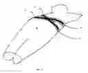 Fig. 06 - Body surface compression with pneumatic shortening element