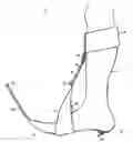 Fig. 01 - Plantar flexion prevention device