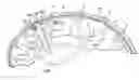 Fig. 01 - Implantable micro-system for treatment of hydrocephalus