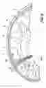 Fig. 08 - Implantable micro-system for treatment of hydrocephalus