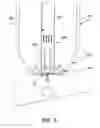 Fig. 05 - Method and apparatus for treating meibomian gland dysfunction
