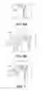 Fig. 06 - Method and apparatus for treating meibomian gland dysfunction
