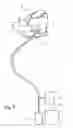 Fig. 02 - Device for the intermittent occlusion of the coronary sinus