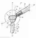 Fig. 01 - Tissue removal device