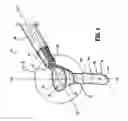 Fig. 02 - Tissue removal device