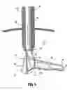 Fig. 08 - Tissue removal device