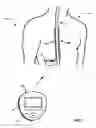 Fig. 02 - Therapy adjustment