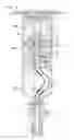 Fig. 01 - All-in-one means of separating blood components