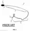 Fig. 02 - Micro-fabricated Catheter Devices Formed Having Elastomeric Compositions