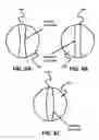 Fig. 07 - Micro-fabricated guidewire devices having elastomeric fill compositions