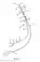 Fig. 02 - Method of using a partial-length, indwelling prostatic catheter having a coiled inflation tube as an anchor
