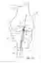Fig. 07 - Method and apparatus for performing ACL reconstruction