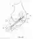 Fig. 08 - Method and apparatus for performing ACL reconstruction