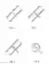 Fig. 03 - Methods and kits for treating fractures with a biological agent