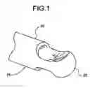 Fig. 02 - Tool to Direct Bone Graft
