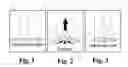 Fig. 02 - APPARATUS AND METHOD FOR WOUND WEAVING AND HEALING