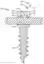 Fig. 01 - SLIDER LOCKING MECHANISM FOR PEDICLE SCREWS