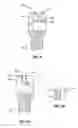 Fig. 04 - SLIDER LOCKING MECHANISM FOR PEDICLE SCREWS